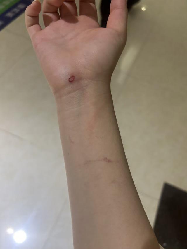 陌生人上门讨说法，18岁女孩独自在家起冲突，警方认定互殴；律师详解法律问题